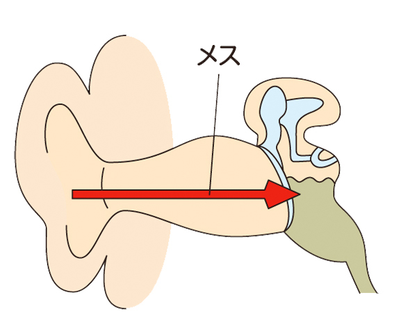 鼓膜切開について